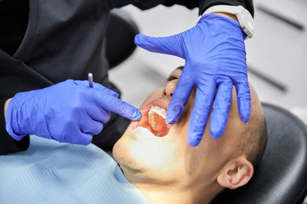 Best Dentist for Tooth Abscess  in Mission, OR